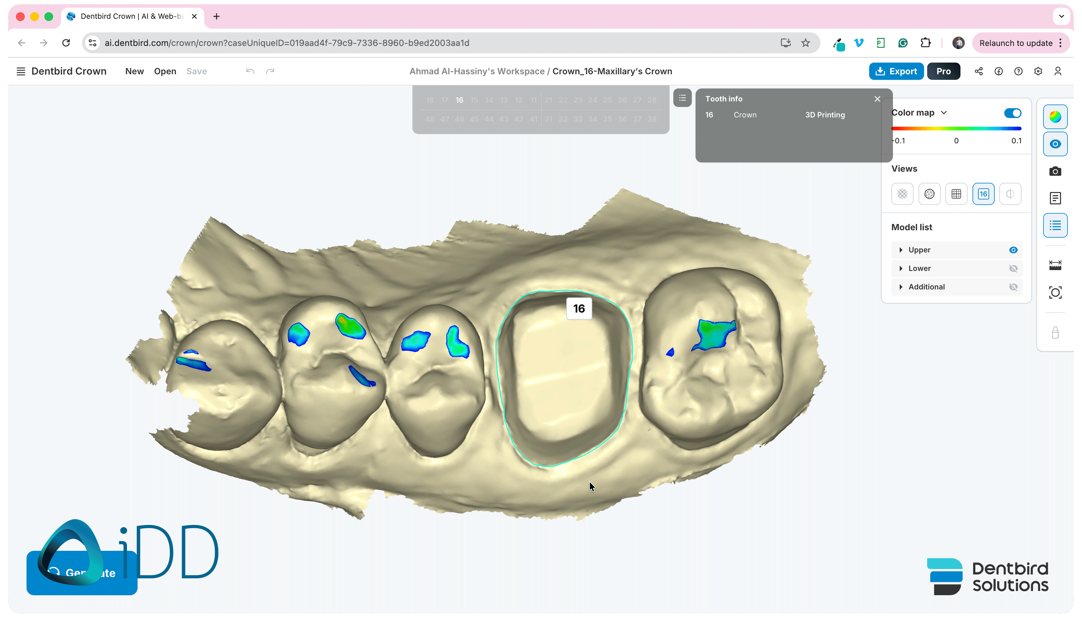 Dentbird Solutions - Dental CAD Software