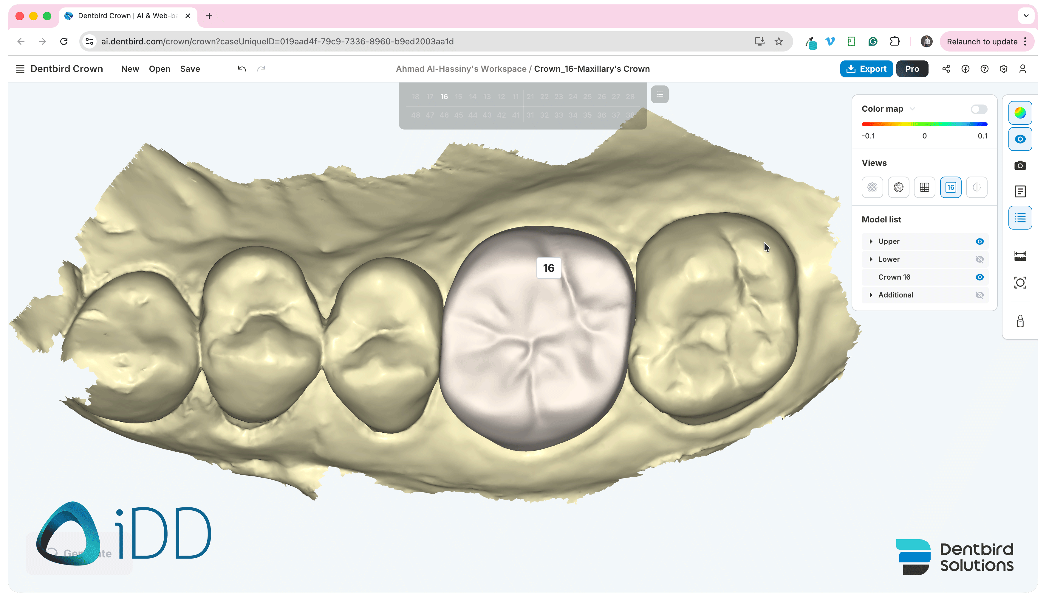 Dentbird Solutions - Dental CAD Software