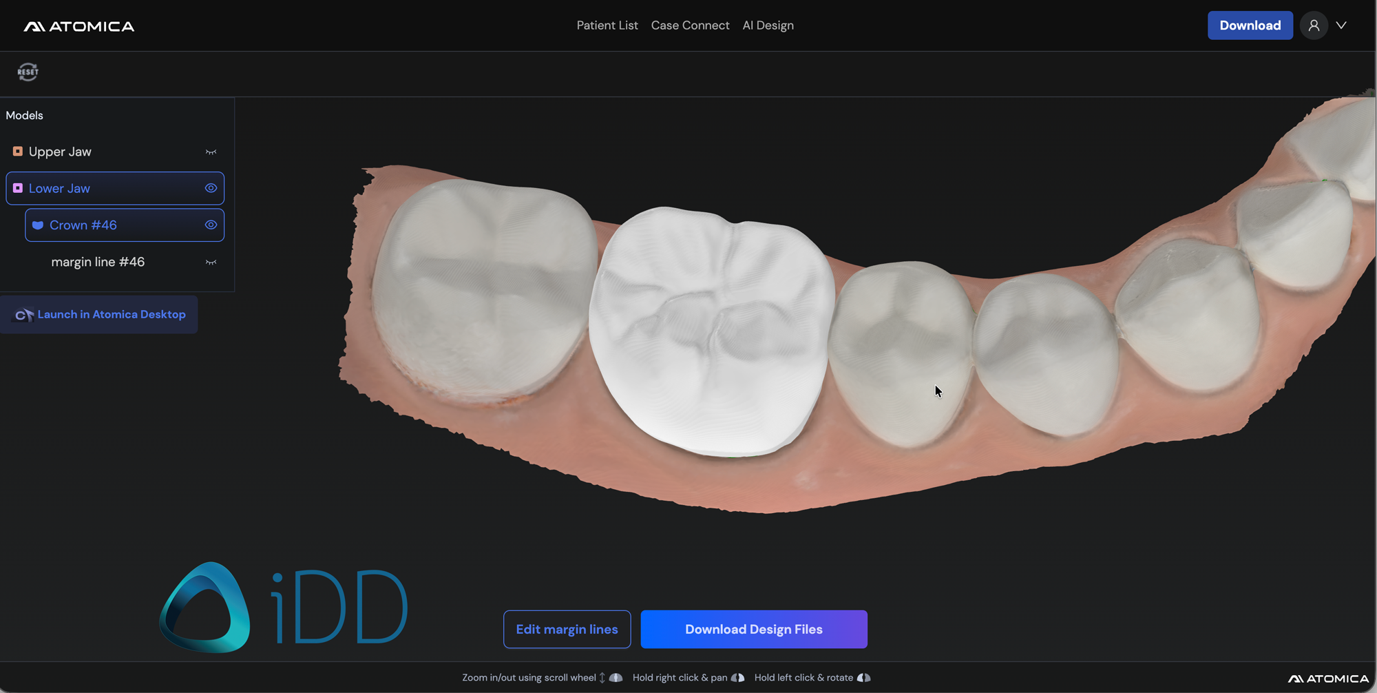 Atomica.ai - Implant Guide Software