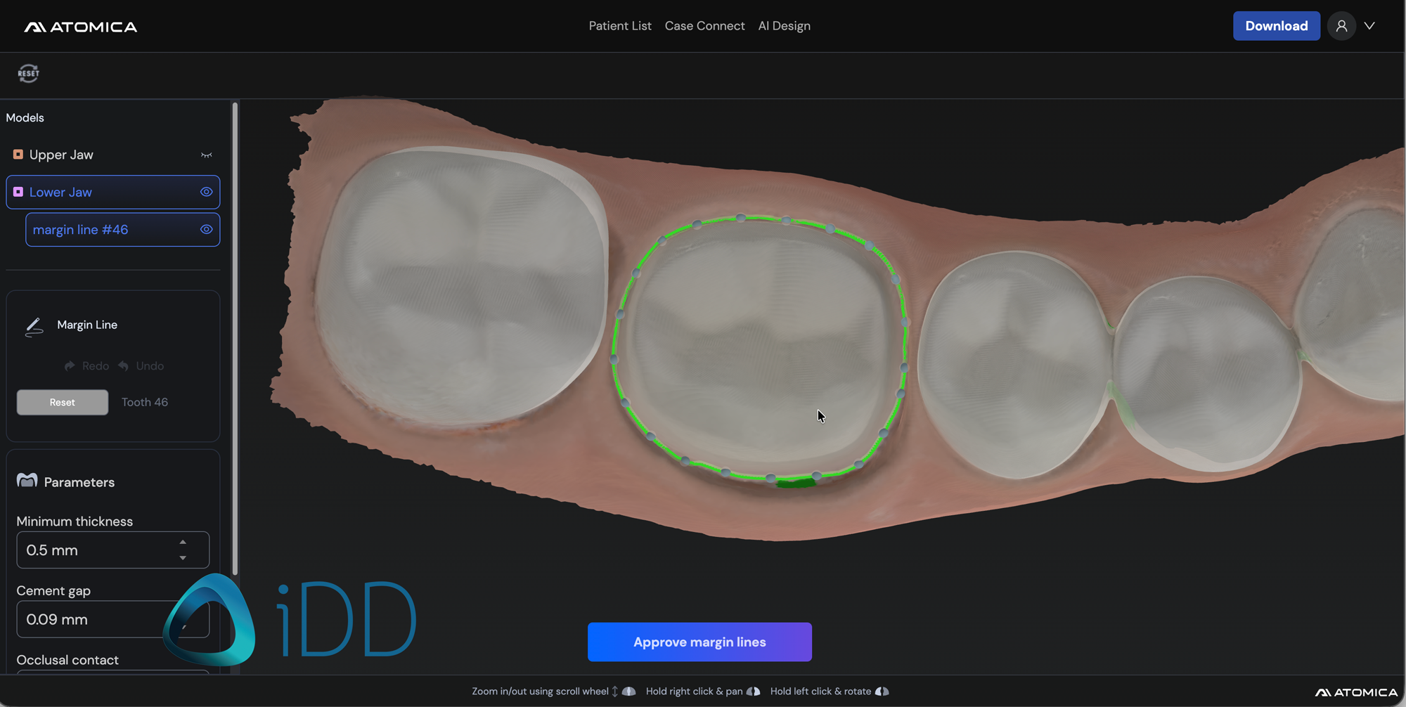 Atomica.ai - Implant Guide Software