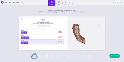 Circle One - Dental CAD Software
