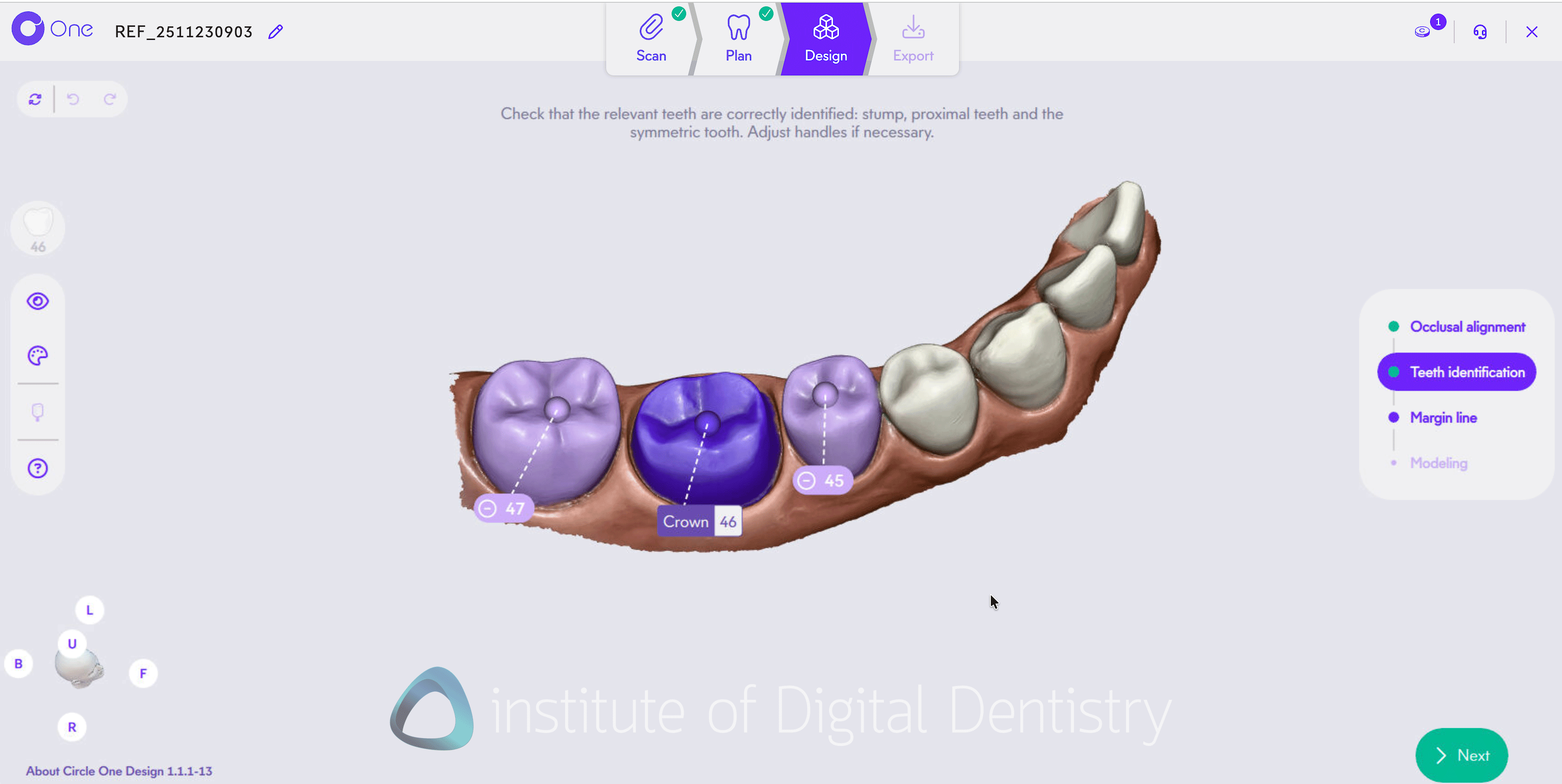 Circle One - Dental CAD Software