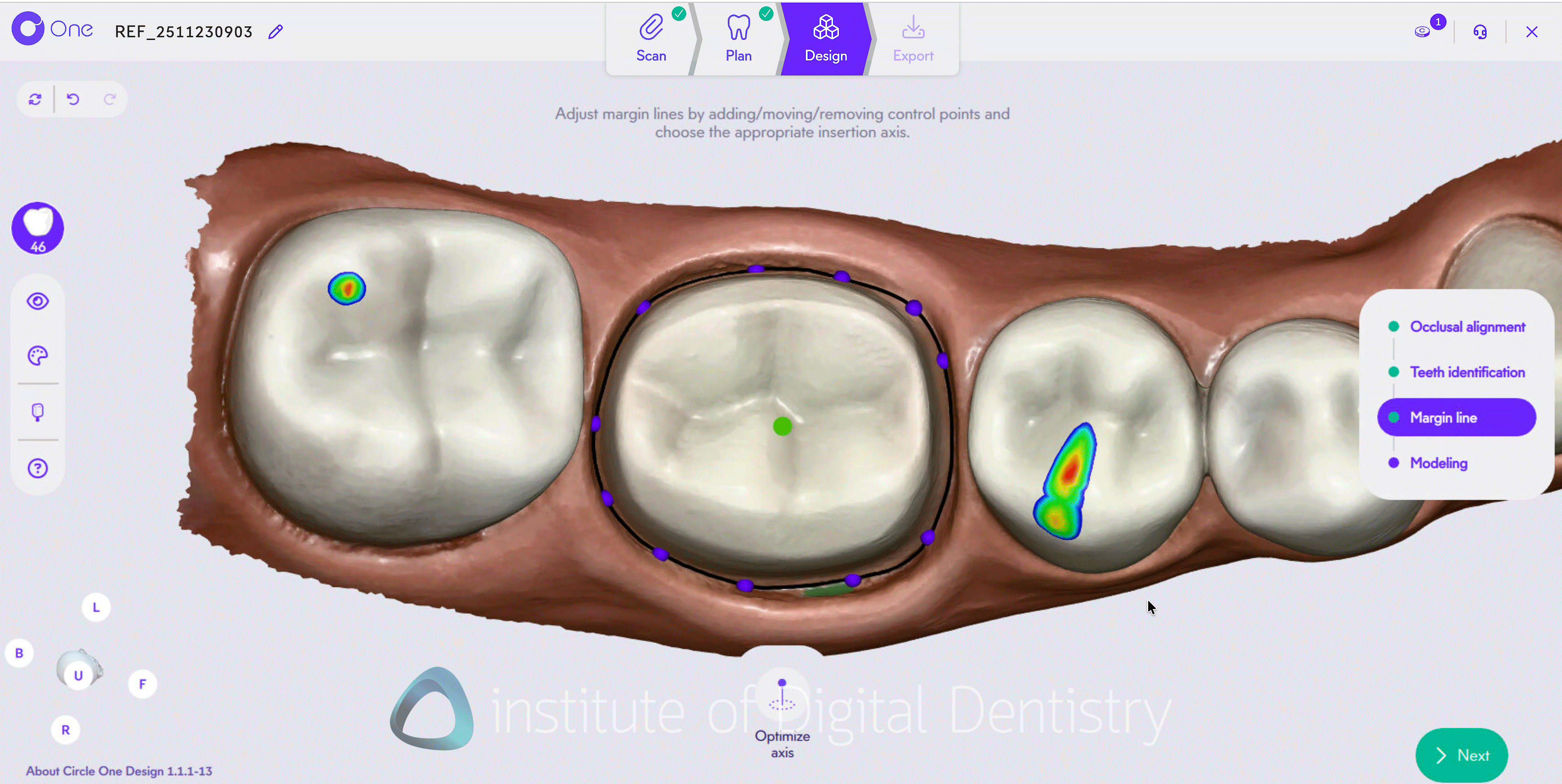 Circle One - Dental CAD Software