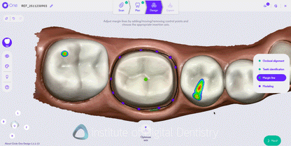 Circle One - Dental CAD Software
