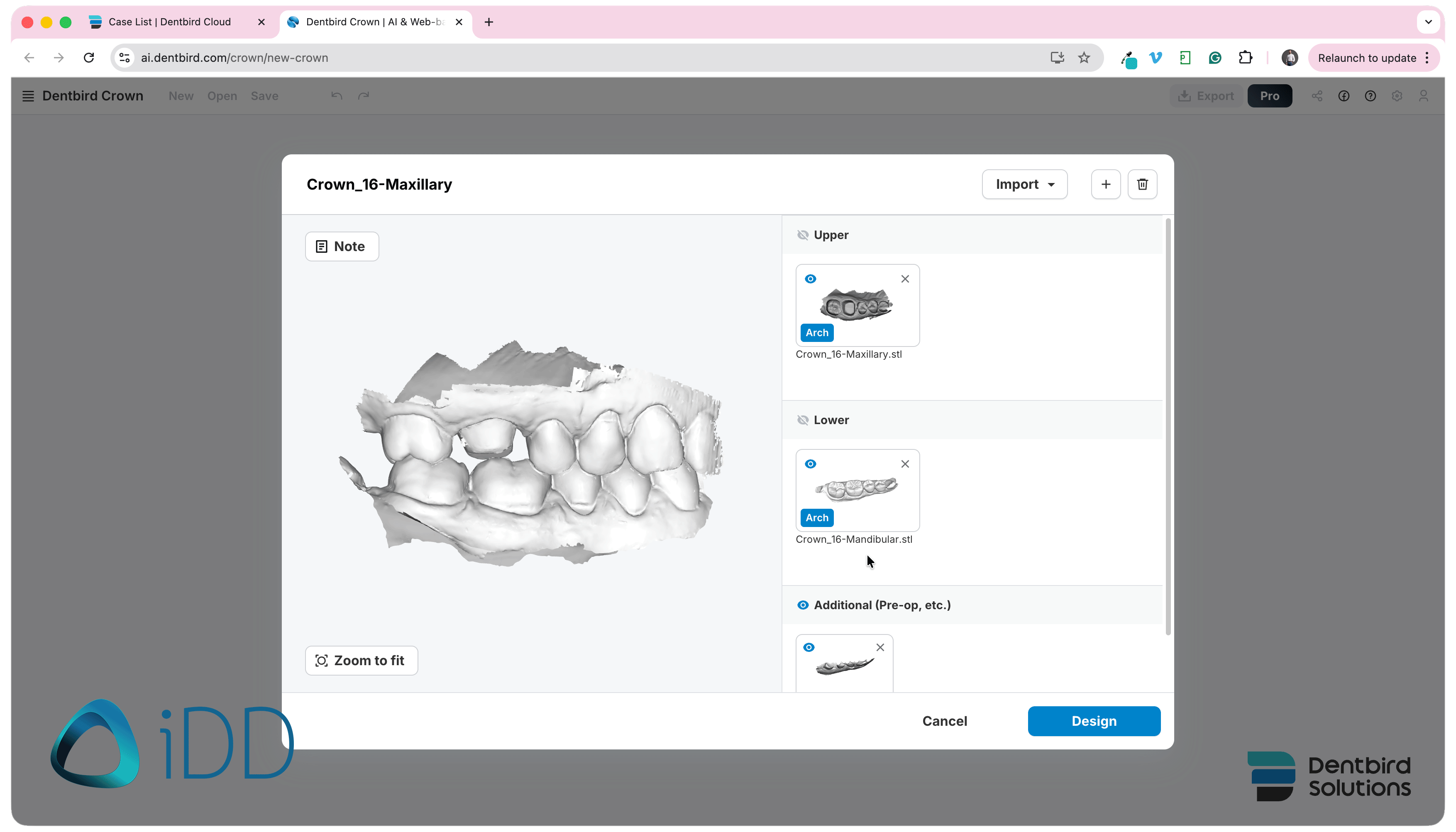 Dentbird Solutions - Dental CAD Software