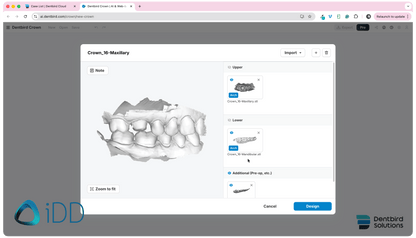 Dentbird Solutions - Dental CAD Software