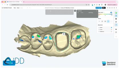 Dentbird Solutions - Dental CAD Software