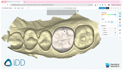 Dentbird Solutions - Dental CAD Software