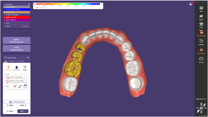 Exocad - DentalCAD Software