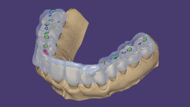 Exocad - DentalCAD Software