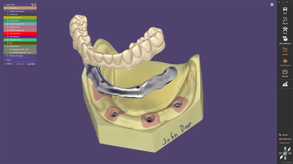 Exocad - DentalCAD Software